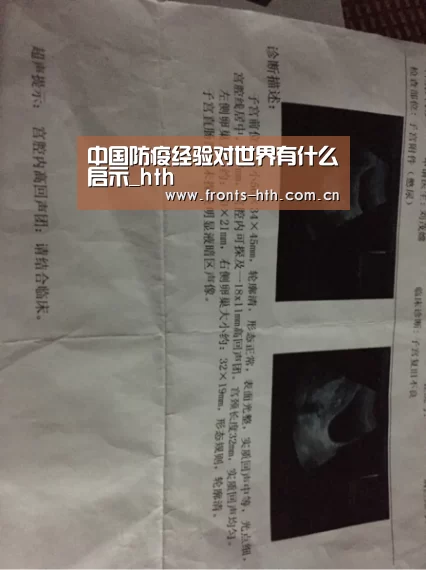 中国防疫经验对世界有什么启示_hth(图3) 中国防疫经验对世界有什么启示_hth(图3)